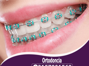 Brackets y la ortodoncia Bogotá Restrepo